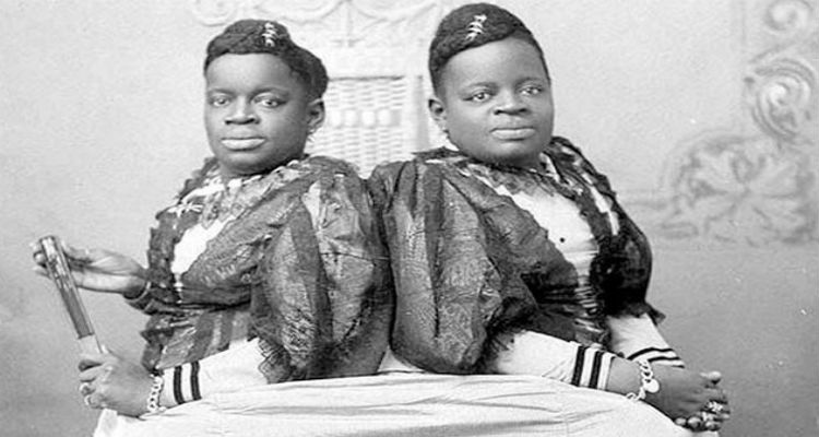 Mille-and-Christine-McKoy Twins, history